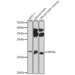 Western Blot - Anti-NRN1L Antibody (A88613) - Antibodies.com