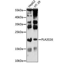 Western Blot - Anti-HRASLS3 Antibody (A88614) - Antibodies.com