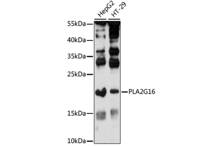 Western Blot - Anti-HRASLS3 Antibody (A88614) - Antibodies.com