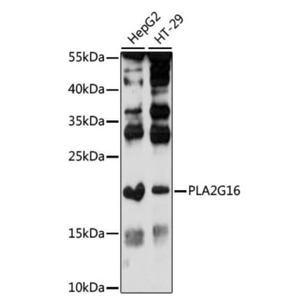 Western Blot - Anti-HRASLS3 Antibody (A88614) - Antibodies.com