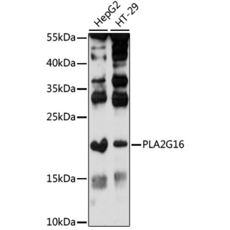 Western Blot - Anti-HRASLS3 Antibody (A88614) - Antibodies.com