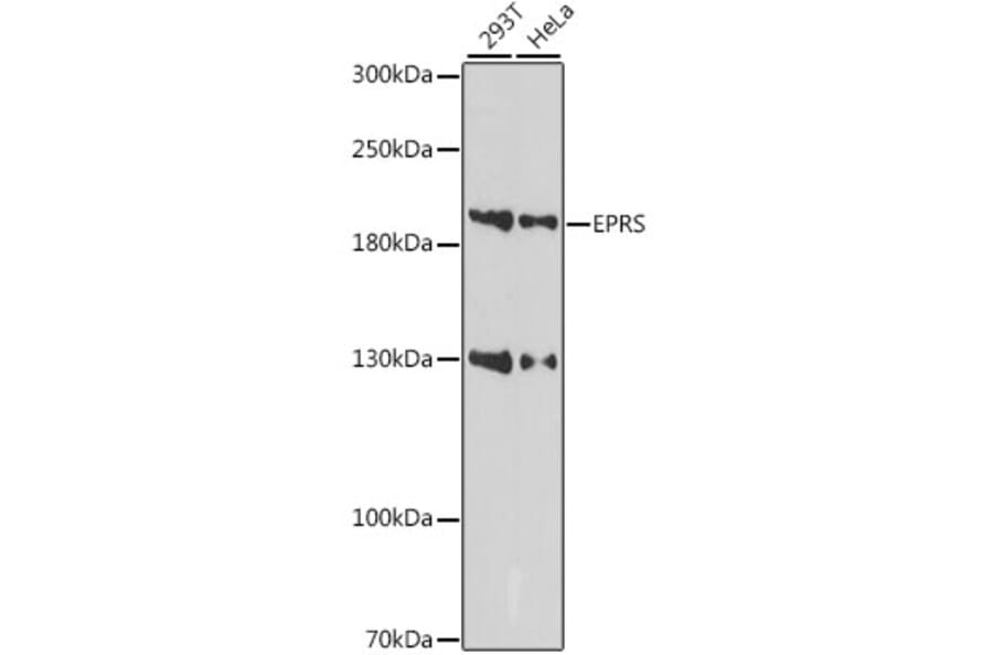 Western Blot - Anti-Glutamyl Prolyl tRNA synthetase/PARS Antibody (A88615) - Antibodies.com