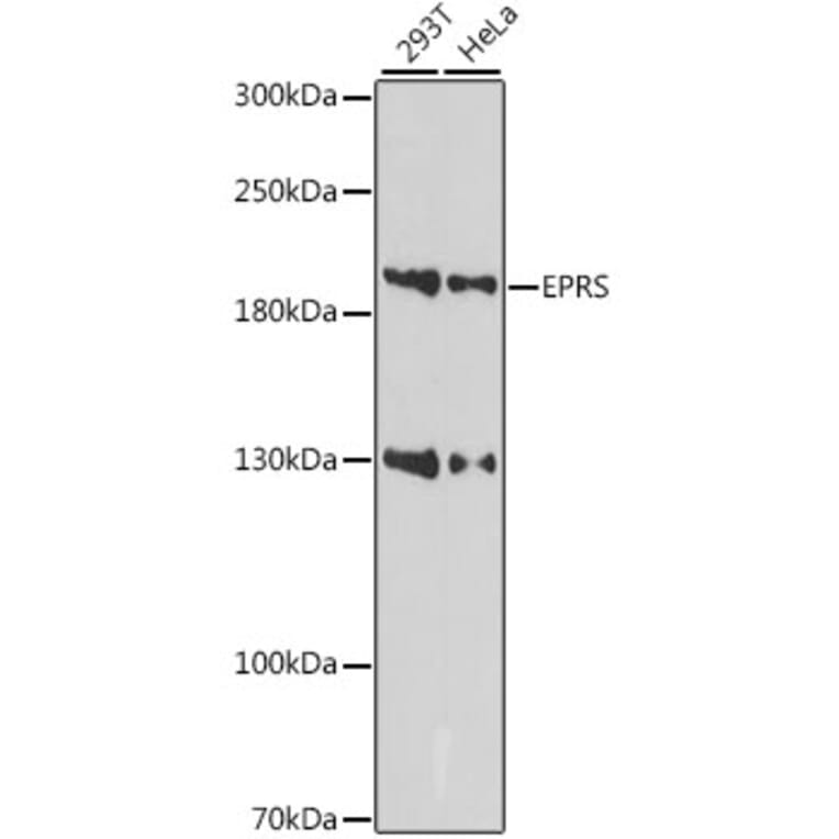 Western Blot - Anti-Glutamyl Prolyl tRNA synthetase/PARS Antibody (A88615) - Antibodies.com