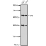 Western Blot - Anti-Glutamyl Prolyl tRNA synthetase/PARS Antibody (A88615) - Antibodies.com