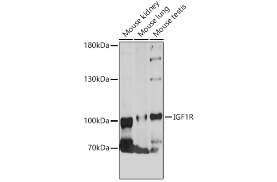 Western Blot - Anti-IGF1 Receptor Antibody (A88616) - Antibodies.com