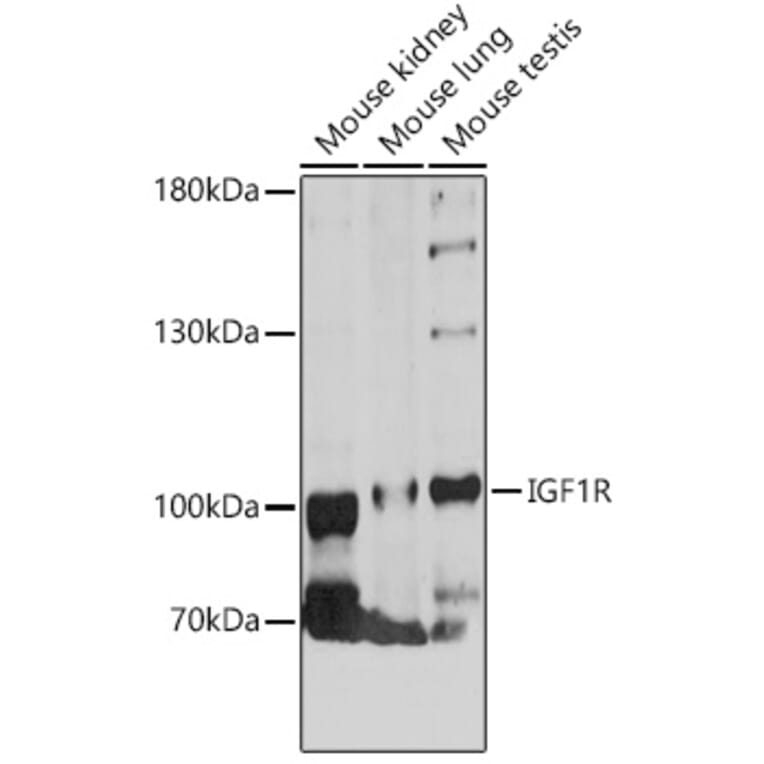 Western Blot - Anti-IGF1 Receptor Antibody (A88616) - Antibodies.com