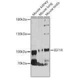 Western Blot - Anti-IGF1 Receptor Antibody (A88616) - Antibodies.com