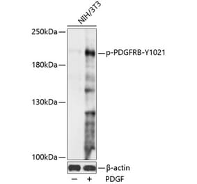 Western Blot - Anti-PDGFR beta (phospho Tyr1021) Antibody (A88617) - Antibodies.com