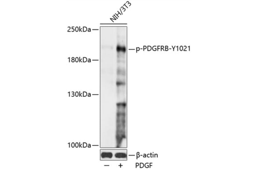 Western Blot - Anti-PDGFR beta (phospho Tyr1021) Antibody (A88617) - Antibodies.com