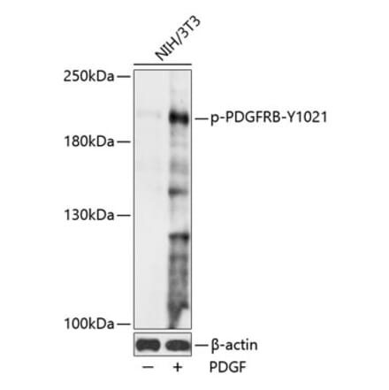 Western Blot - Anti-PDGFR beta (phospho Tyr1021) Antibody (A88617) - Antibodies.com