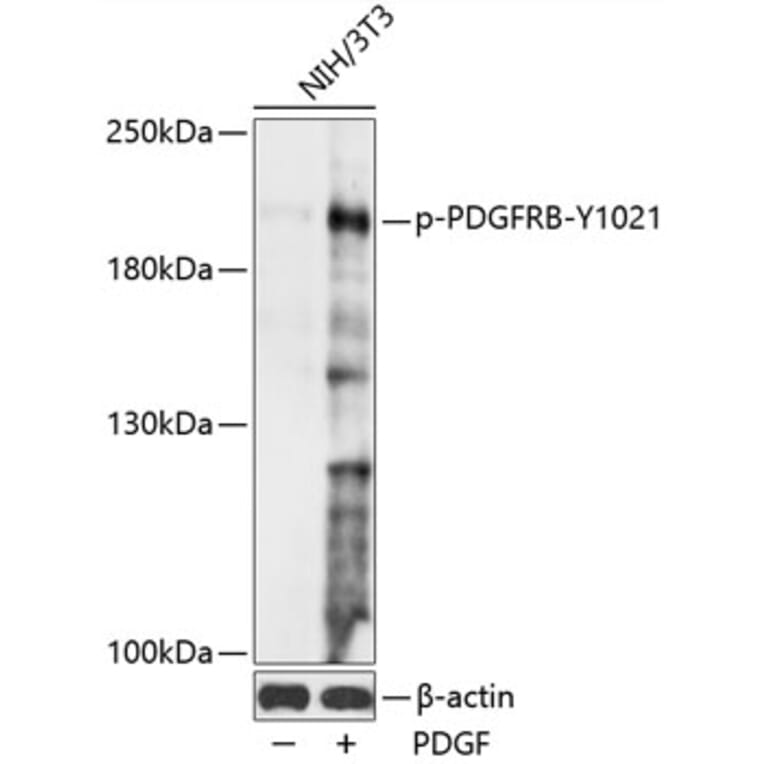 Western Blot - Anti-PDGFR beta (phospho Tyr1021) Antibody (A88617) - Antibodies.com