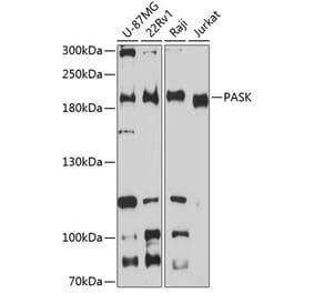 Western Blot - Anti-PASK Antibody (A88618) - Antibodies.com