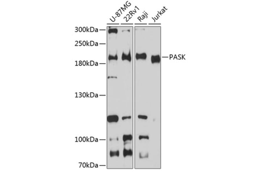 Western Blot - Anti-PASK Antibody (A88618) - Antibodies.com