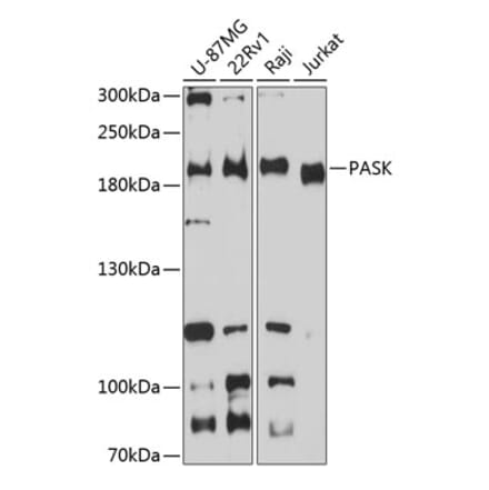 Western Blot - Anti-PASK Antibody (A88618) - Antibodies.com