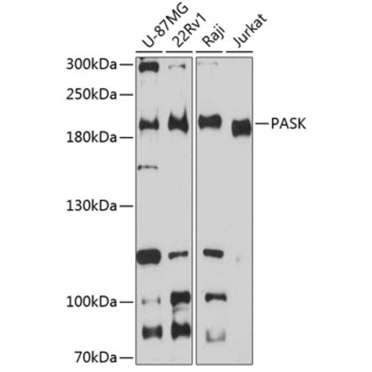 Western Blot - Anti-PASK Antibody (A88618) - Antibodies.com