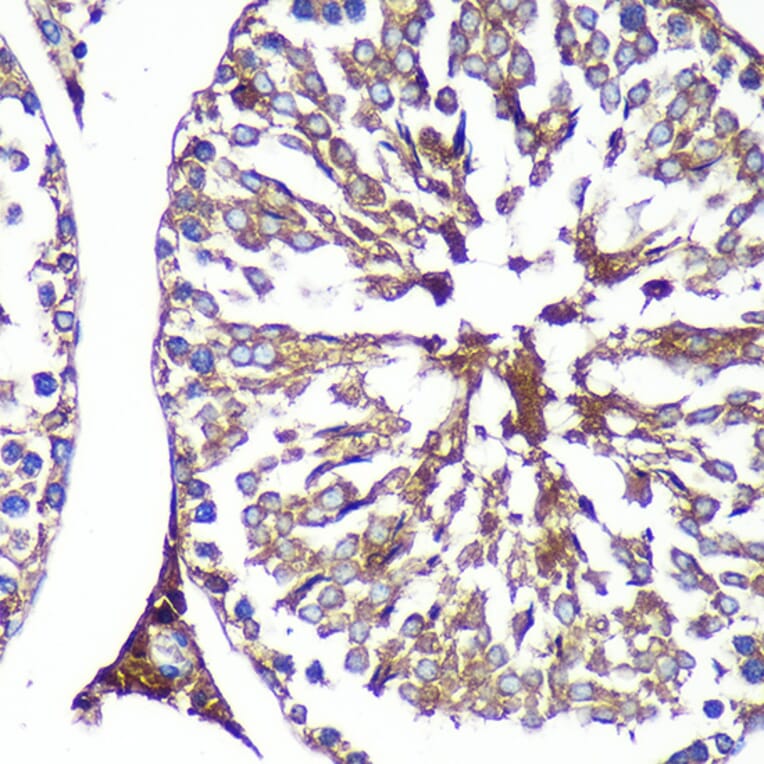 Immunohistochemistry - Anti-PASK Antibody (A88618) - Antibodies.com