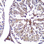 Immunohistochemistry - Anti-PASK Antibody (A88618) - Antibodies.com