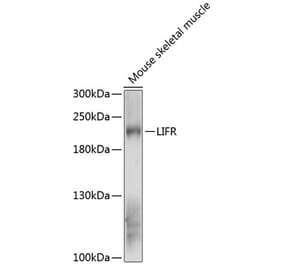 Western Blot - Anti-LIFR Antibody (A88619) - Antibodies.com