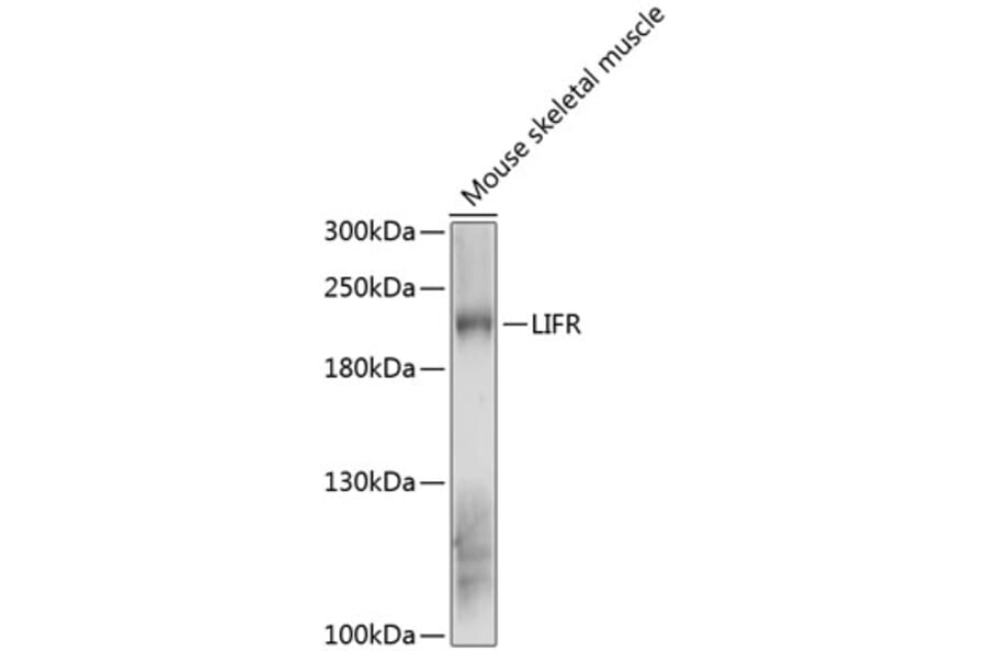 Western Blot - Anti-LIFR Antibody (A88619) - Antibodies.com