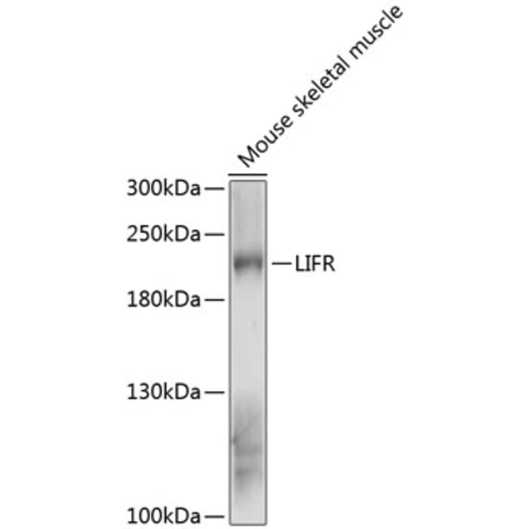 Western Blot - Anti-LIFR Antibody (A88619) - Antibodies.com