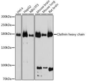 Western Blot - Anti-Clathrin heavy chain Antibody (A88620) - Antibodies.com