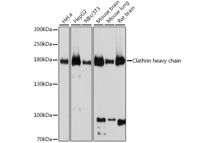 Western Blot - Anti-Clathrin heavy chain Antibody (A88620) - Antibodies.com