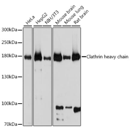 Western Blot - Anti-Clathrin heavy chain Antibody (A88620) - Antibodies.com