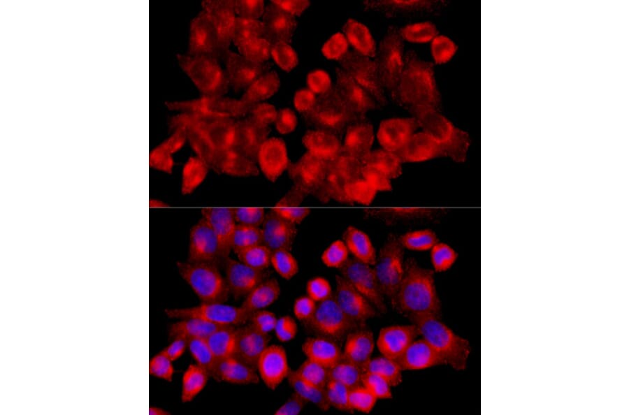 Immunofluorescence - Anti-Clathrin heavy chain Antibody (A88620) - Antibodies.com