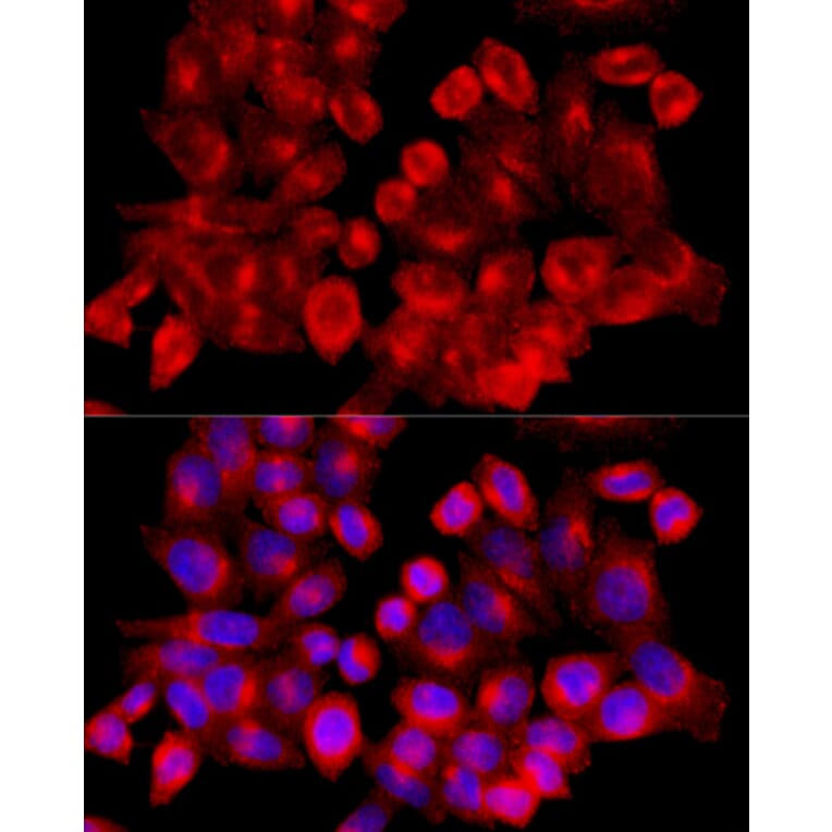 Immunofluorescence - Anti-Clathrin heavy chain Antibody (A88620) - Antibodies.com