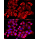 Immunofluorescence - Anti-Clathrin heavy chain Antibody (A88620) - Antibodies.com