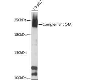 Western Blot - Anti-C4a Antibody (A88621) - Antibodies.com