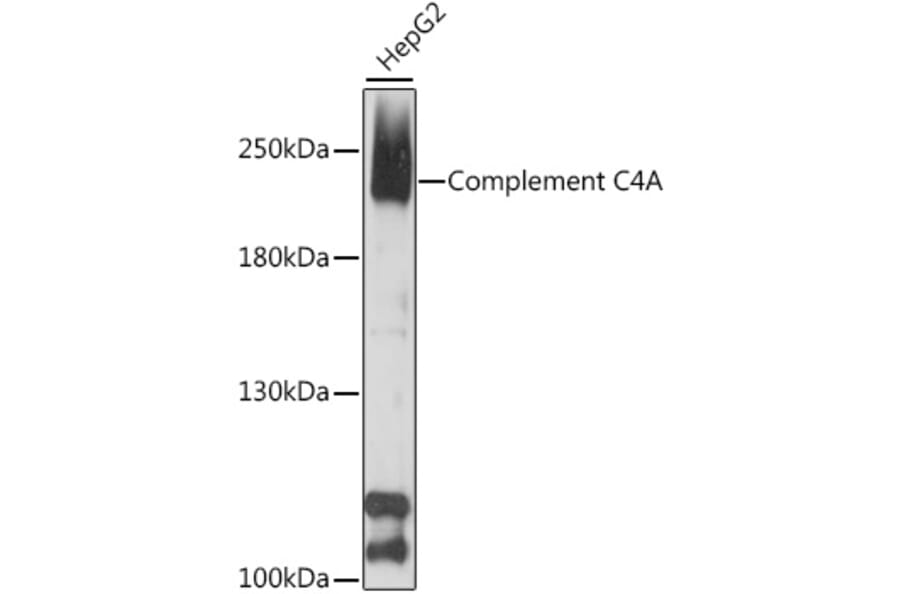 Western Blot - Anti-C4a Antibody (A88621) - Antibodies.com