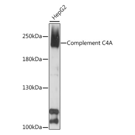 Western Blot - Anti-C4a Antibody (A88621) - Antibodies.com