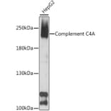 Western Blot - Anti-C4a Antibody (A88621) - Antibodies.com