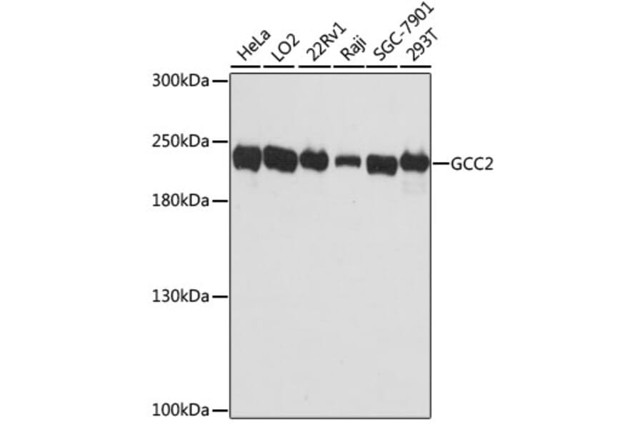 Western Blot - Anti-GCC185 Antibody (A88622) - Antibodies.com