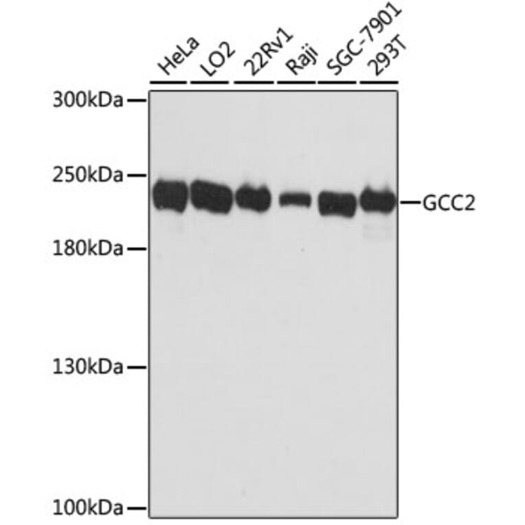 Western Blot - Anti-GCC185 Antibody (A88622) - Antibodies.com
