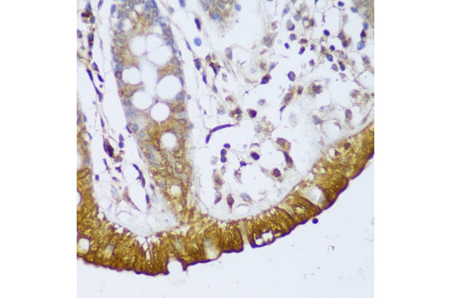 Immunohistochemistry - Anti-GCC185 Antibody (A88622) - Antibodies.com