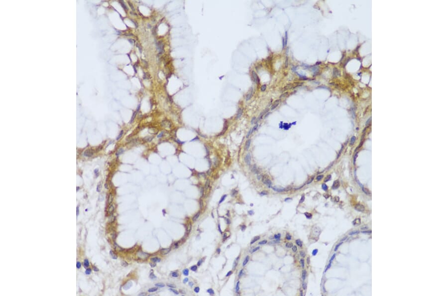 Immunohistochemistry - Anti-GCC185 Antibody (A88622) - Antibodies.com