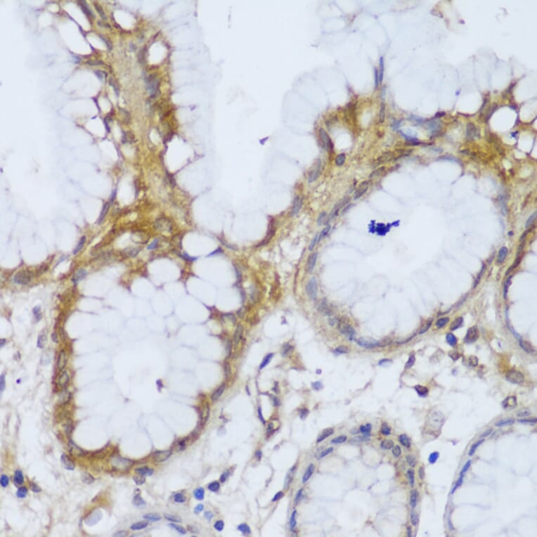 Immunohistochemistry - Anti-GCC185 Antibody (A88622) - Antibodies.com