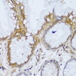 Immunohistochemistry - Anti-GCC185 Antibody (A88622) - Antibodies.com