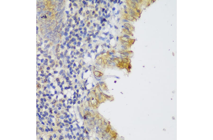 Immunohistochemistry - Anti-GCC185 Antibody (A88622) - Antibodies.com