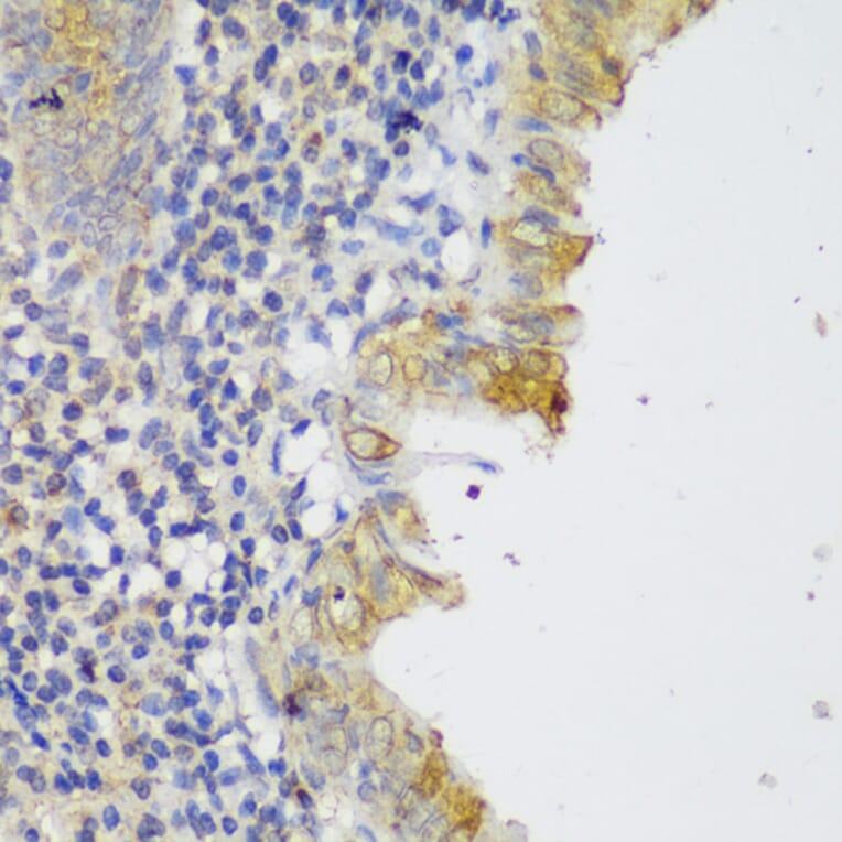 Immunohistochemistry - Anti-GCC185 Antibody (A88622) - Antibodies.com