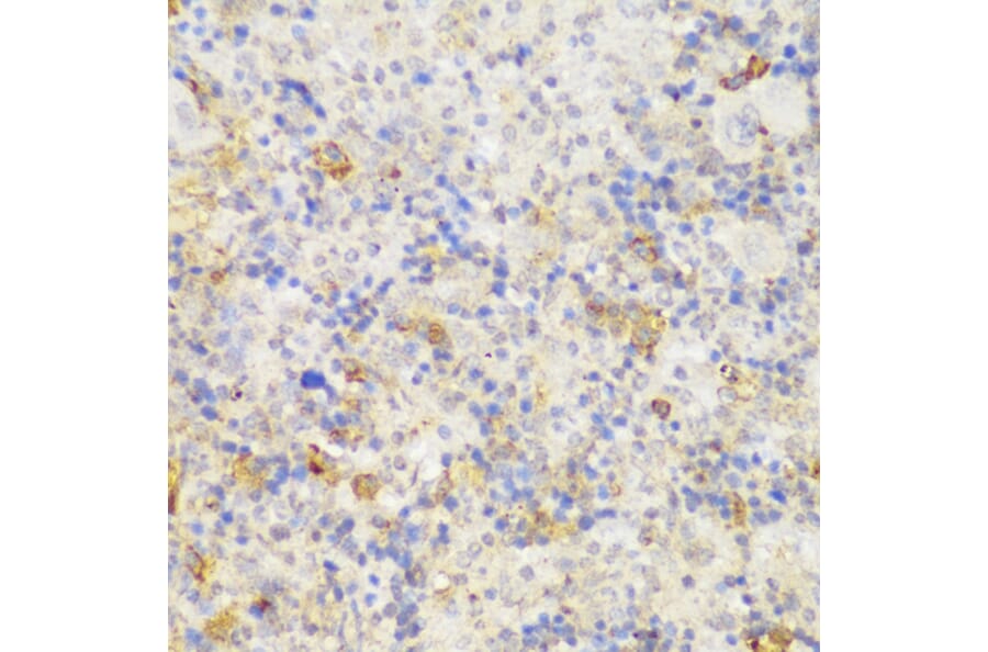 Immunohistochemistry - Anti-GCC185 Antibody (A88622) - Antibodies.com