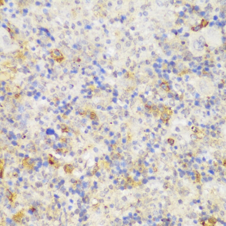 Immunohistochemistry - Anti-GCC185 Antibody (A88622) - Antibodies.com