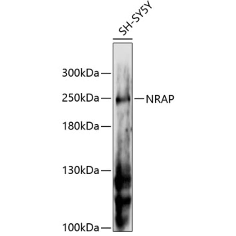 Western Blot - Anti-NRAP Antibody (A88623) - Antibodies.com