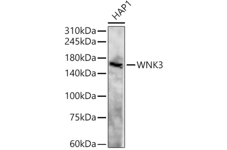 Western Blot - Anti-WNK3 Antibody (A88624) - Antibodies.com