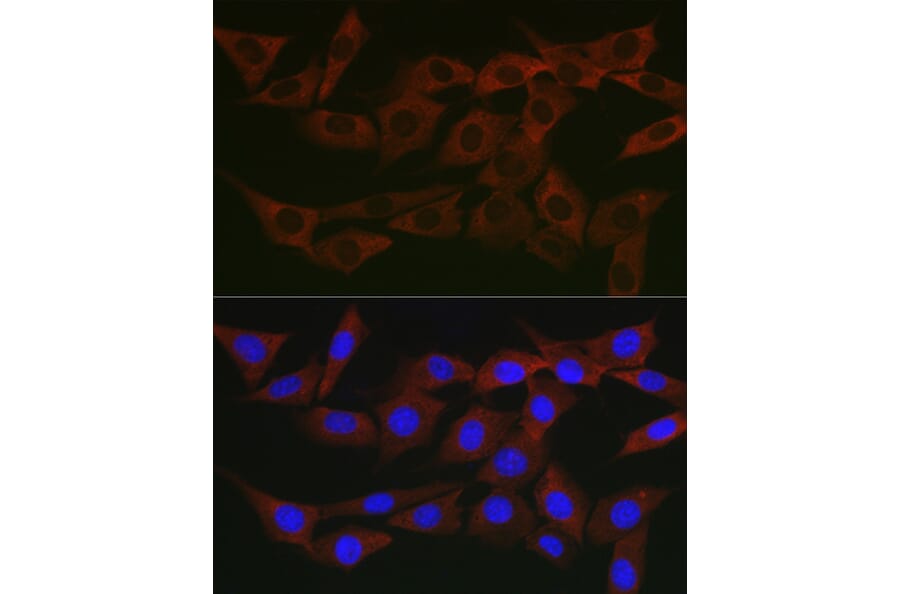 Immunofluorescence - Anti-WNK3 Antibody (A88624) - Antibodies.com