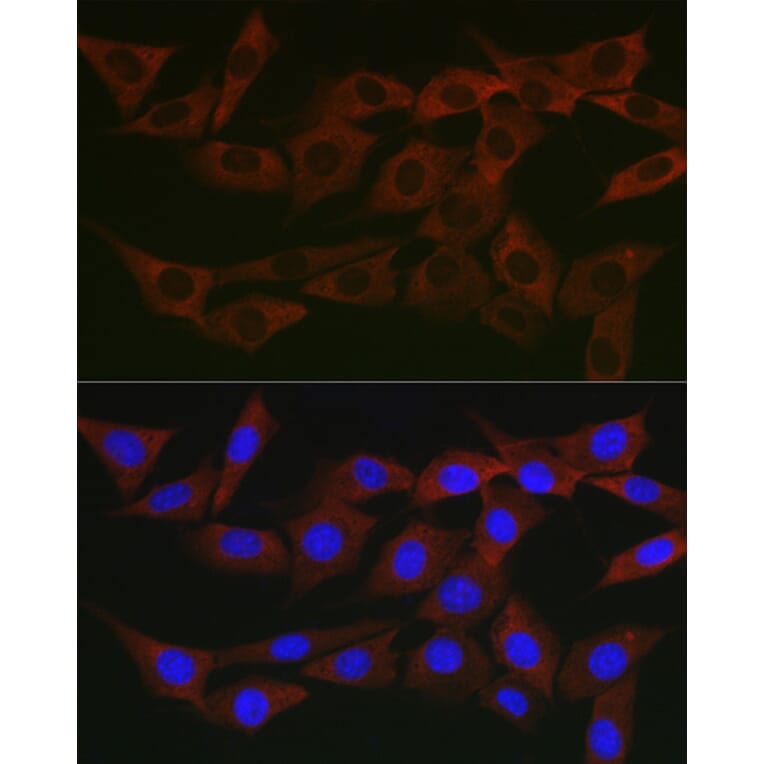 Immunofluorescence - Anti-WNK3 Antibody (A88624) - Antibodies.com