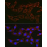 Immunofluorescence - Anti-WNK3 Antibody (A88624) - Antibodies.com