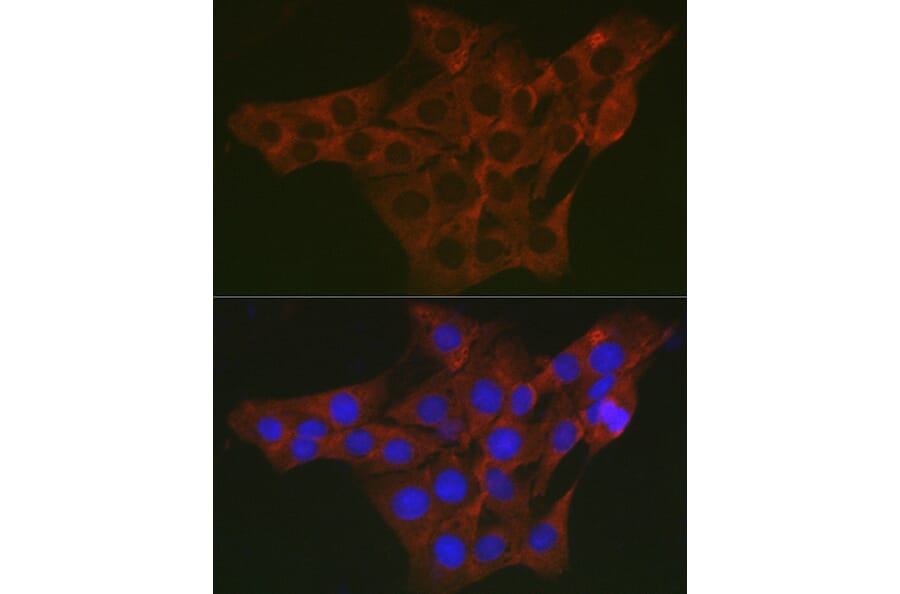 Immunofluorescence - Anti-WNK3 Antibody (A88624) - Antibodies.com